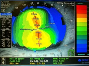MA RétINE Opticiens & Lunetiers - Optométriste / Orthokératologie