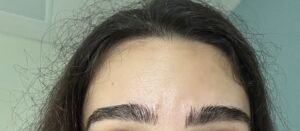 OPH•78 Centre Ophtalmologique de l'Ouest Parisien